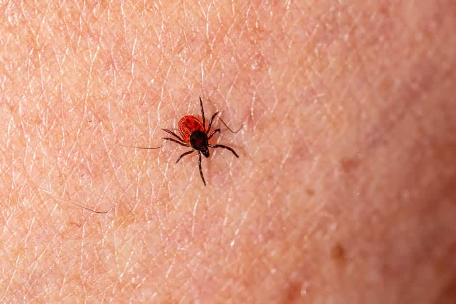 tick control Andover MA